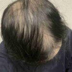 レス2番の画像1